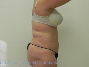 americanlipocenters_191.jpg